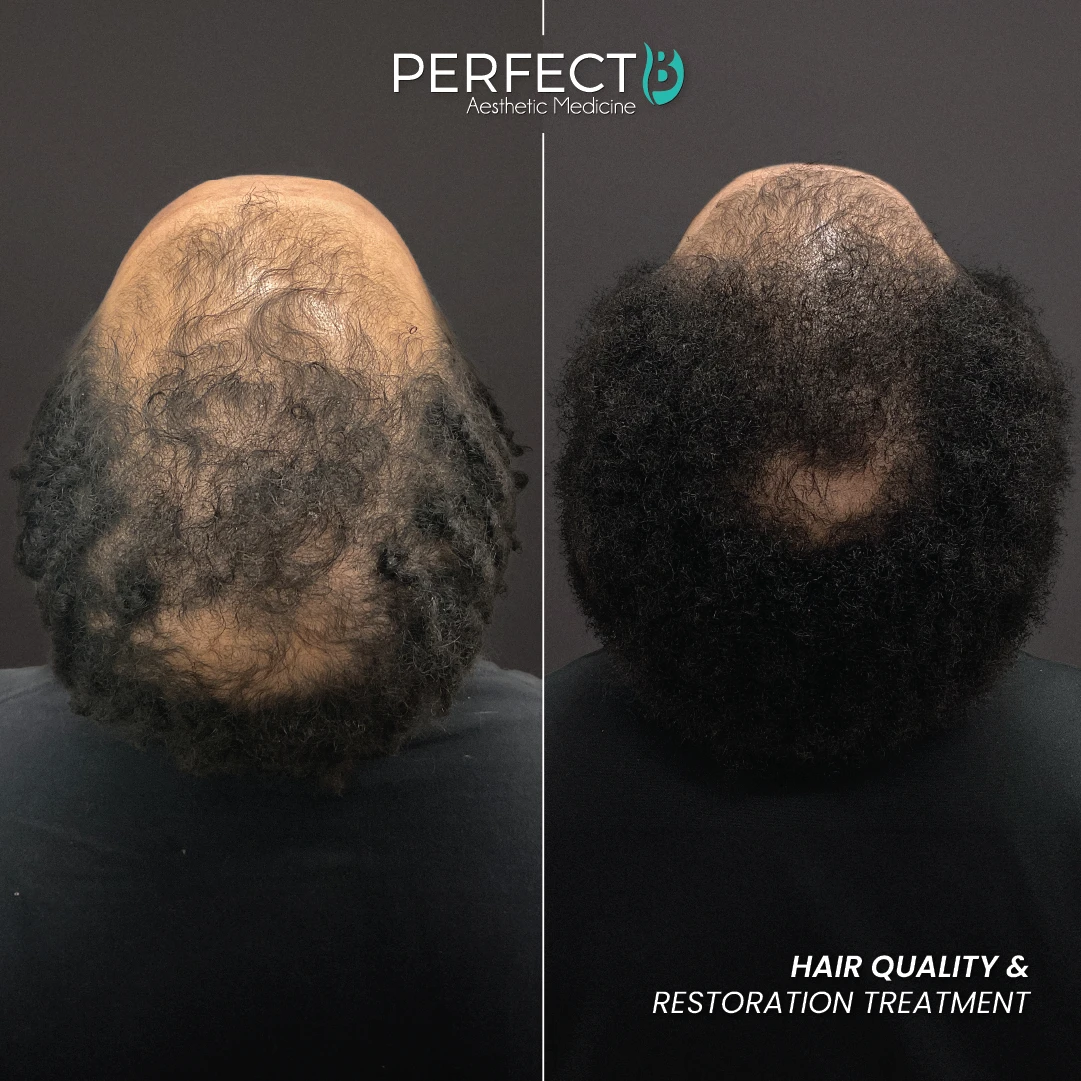 Hair Quality & Restoration Treatent - Perfect B - Results Image - Case 6406 - 1080 x 1080