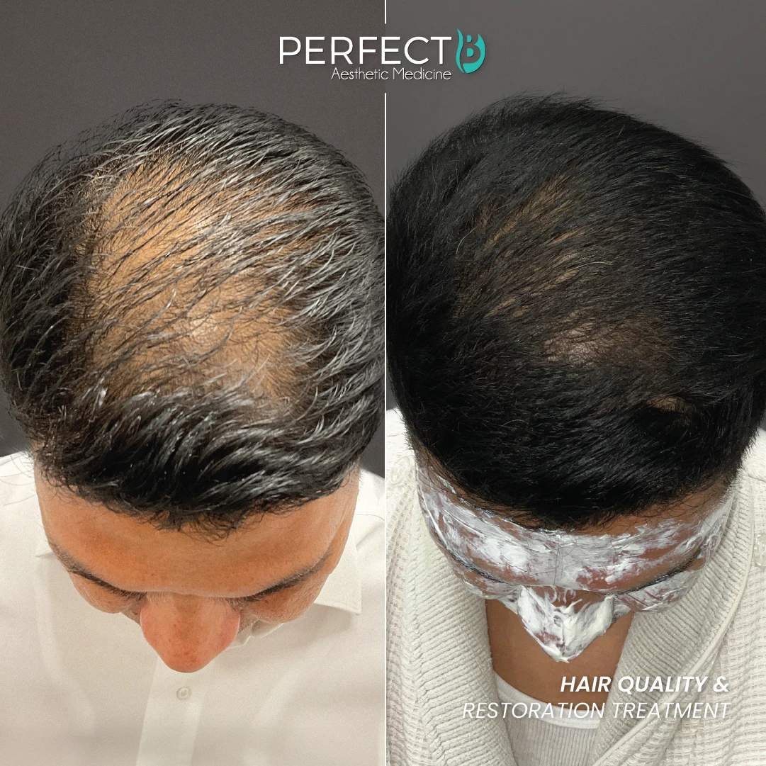 Hair Quality & Restoration Treatent - Perfect B - Results Image - Case 6407 - 1080 x 1080