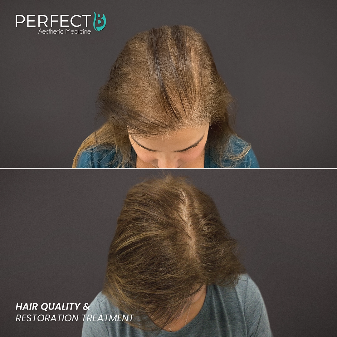 Hair Quality & Restoration Treatment - Perfect B - Results Image - Case 6401 - 1080 x 1080