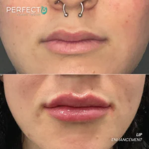Kristin Zaldivar - Lip Enhacement_Results Image - [Lip Enhancement] 4001 - 1080 x 1080