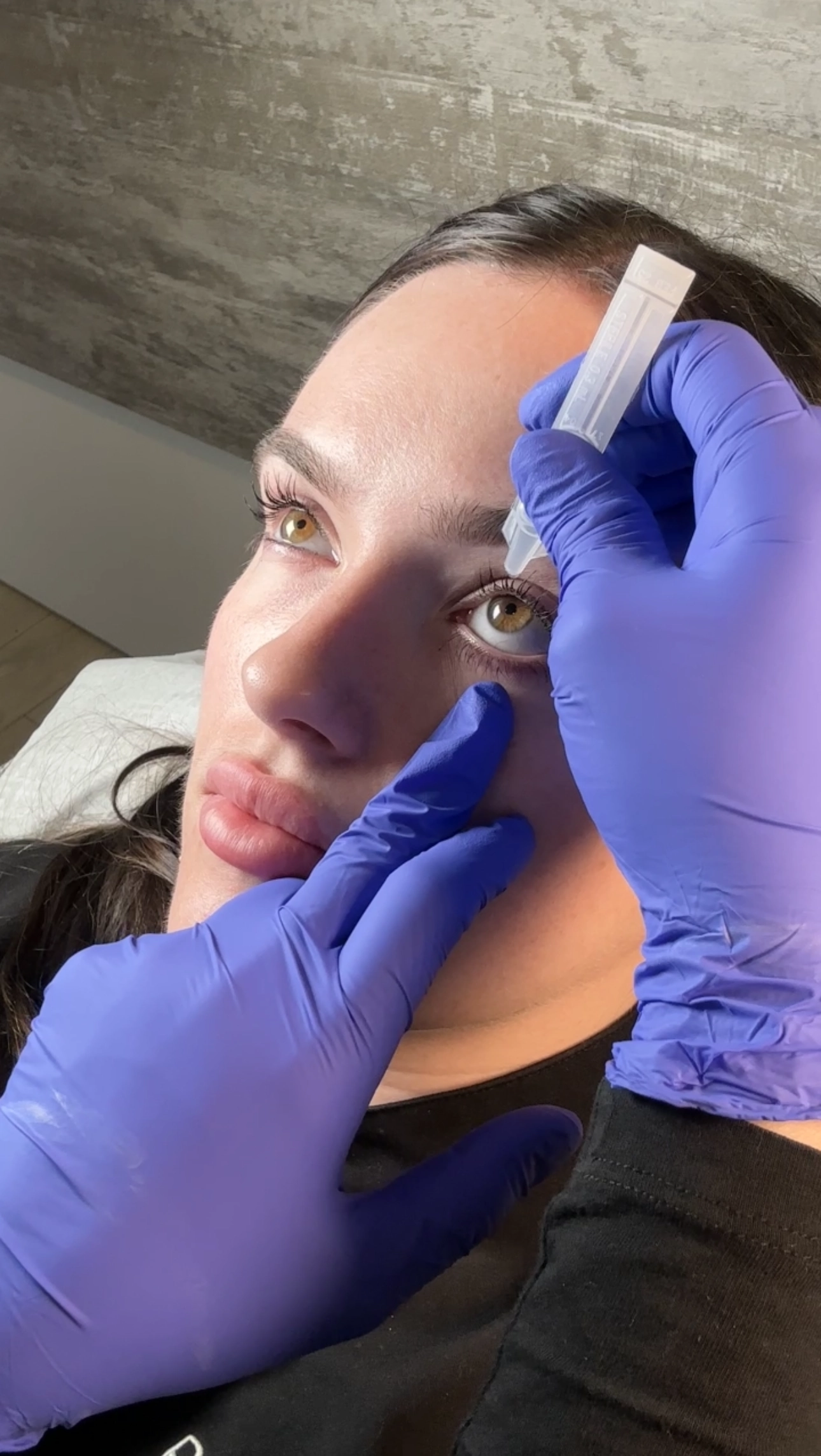 Upneeq Application Perfect B, medical aesthetics clinic in Doral, Miami, FL
