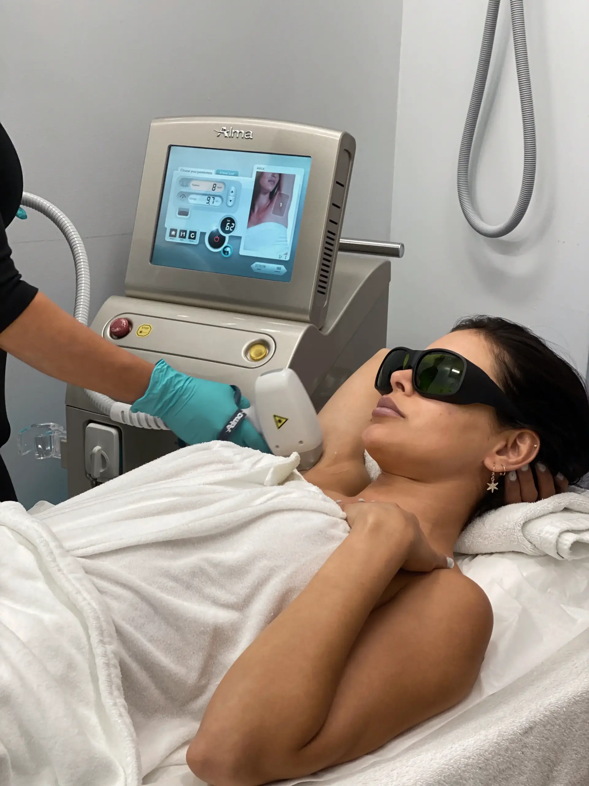 Perfect B - Blog - Everything you need to know about laser hair removal - underarm treatment with an Alma Soprano laser at Perfect B in Doral, Miami, FL
