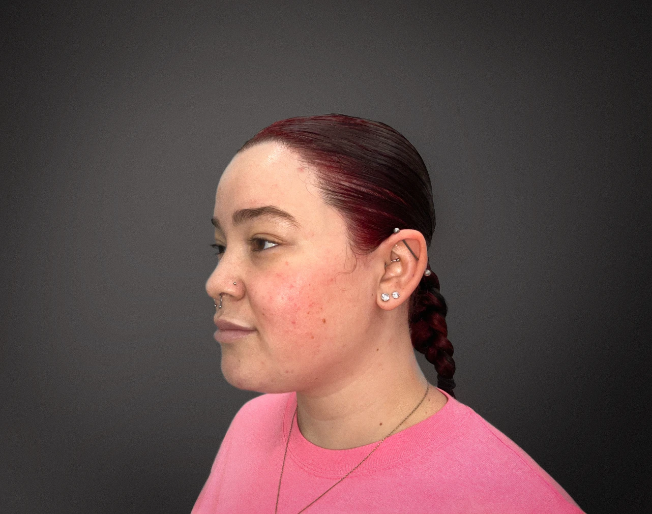 Perfect B - Blog - Rosacea Treatment Plan Step by Step - a patient with rosacea redness on the cheeks who is a good candidate for a professional evaluation