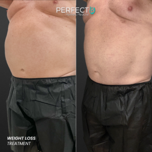 Perfect B - Results Image - [Weight Loss] 4001 - 1080 x 1080