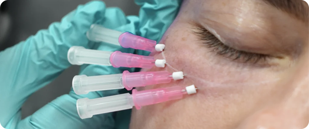 Lorem ipsum dolor sit amet, consectetuer adipiscing elit, sed diam nonummy nibh euismod tincidunt ut laoreet dolore magna aliquam erat volutpat. Can Botox give you a headache - image text