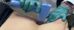 Perfect B - Blogs - Loose skin after losing weight - Hero image