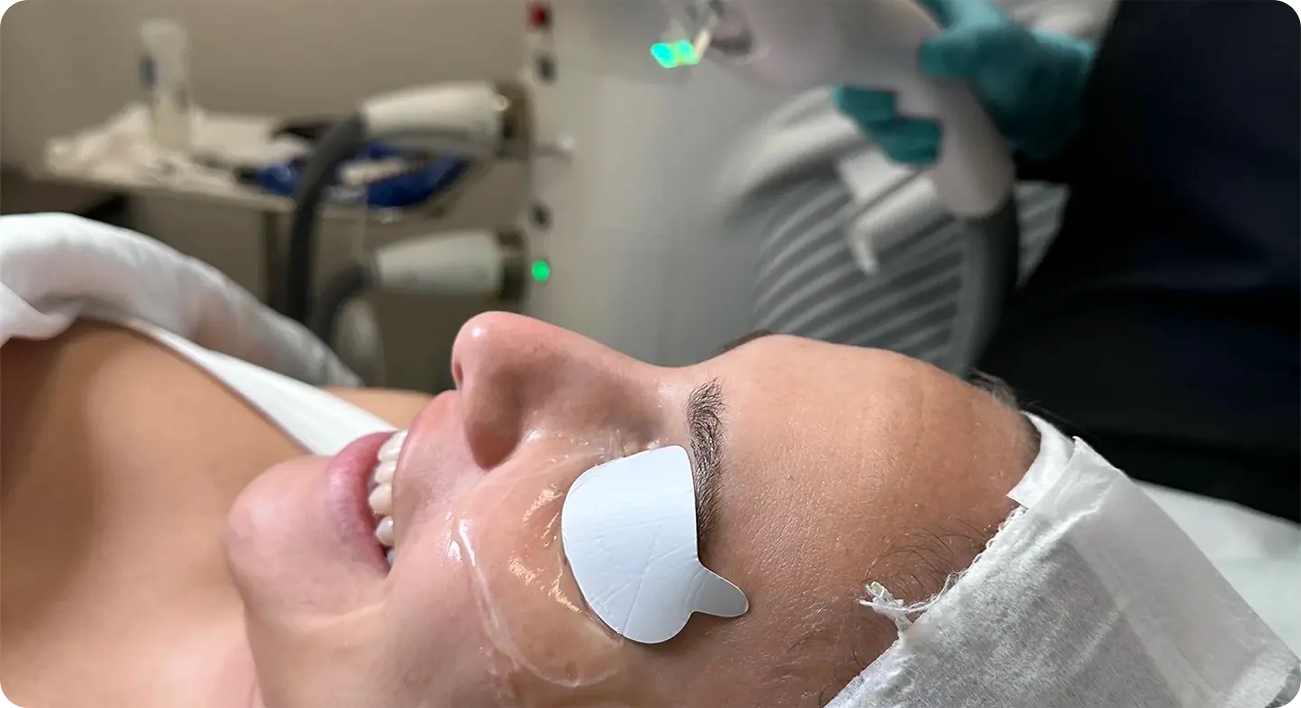 Lorem ipsum dolor sit amet, consectetuer adipiscing elit, sed diam nonummy nibh euismod tincidunt ut laoreet dolore magna aliquam erat volutpat. Illustration of skin aging factors like wrinkles and sagging that can re-emerge after a laser skin treatment