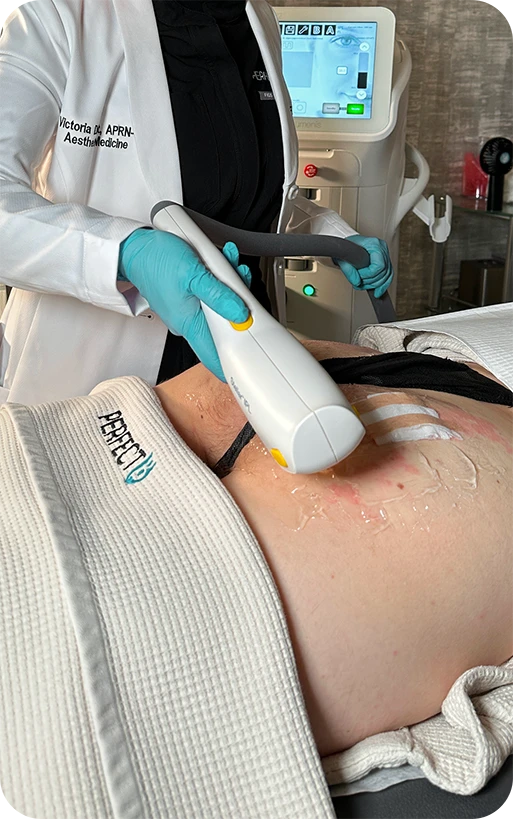 Non-invasive acne vulgaris treatment at Perfect B in Doral, FL, showing clear skin without medication