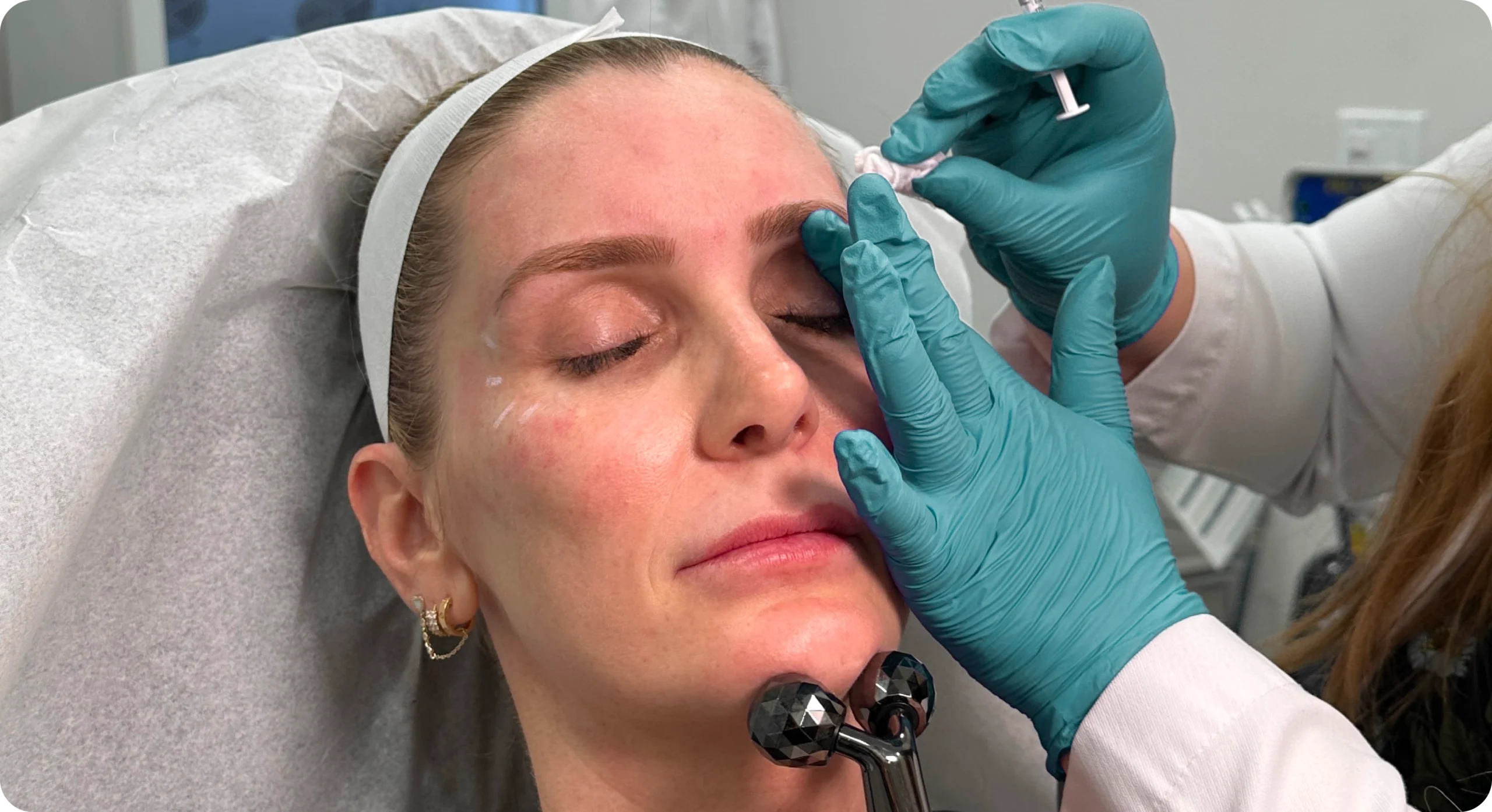 Perfect B - Blog - Forehead Creases - Image2