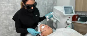 Perfect B - Blog - Glycolic Acid Peel - Hero Image