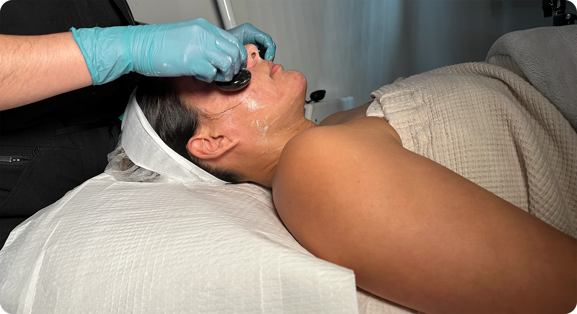 Lorem ipsum dolor sit amet, consectetuer adipiscing elit, sed diam nonummy nibh euismod tincidunt ut laoreet dolore magna aliquam erat volutpat. Facial skin showing acne marks and post-inflammatory hyperpigmentation treated with glycolic acid peels at Perfect B