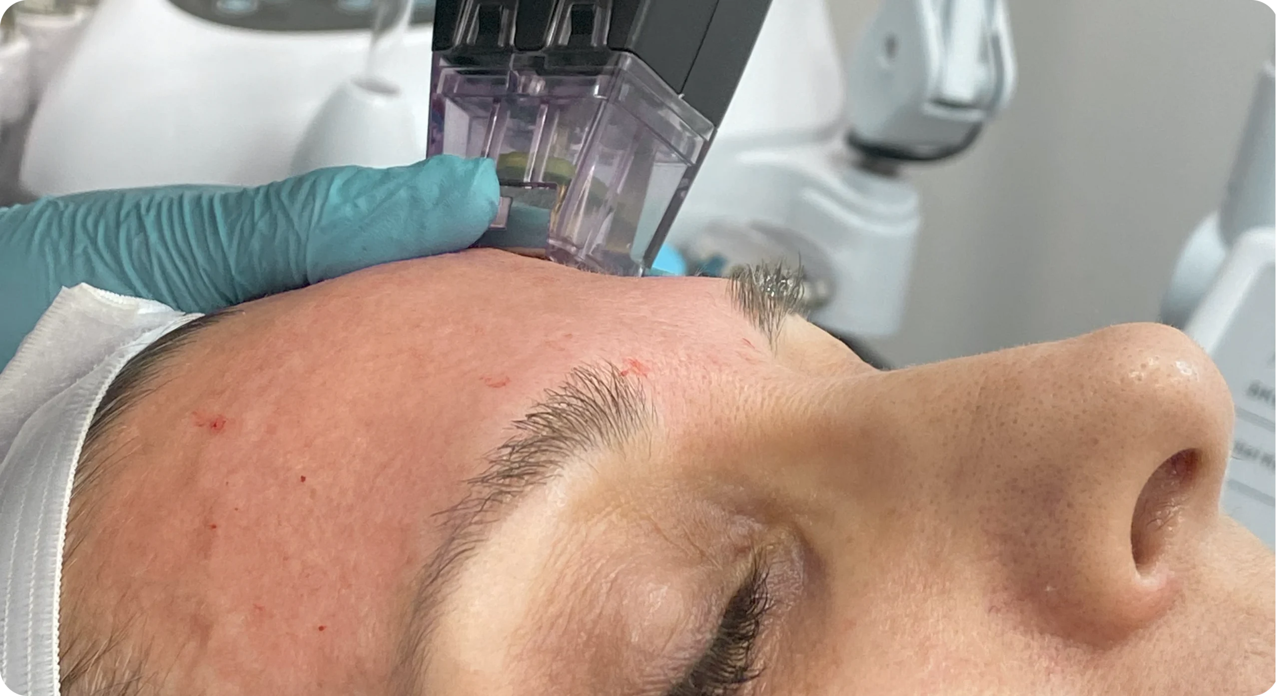 Lorem ipsum dolor sit amet, consectetuer adipiscing elit, sed diam nonummy nibh euismod tincidunt ut laoreet dolore magna aliquam erat volutpat. Close-up of aging skin showing loss of firmness and early signs of sagging on the face