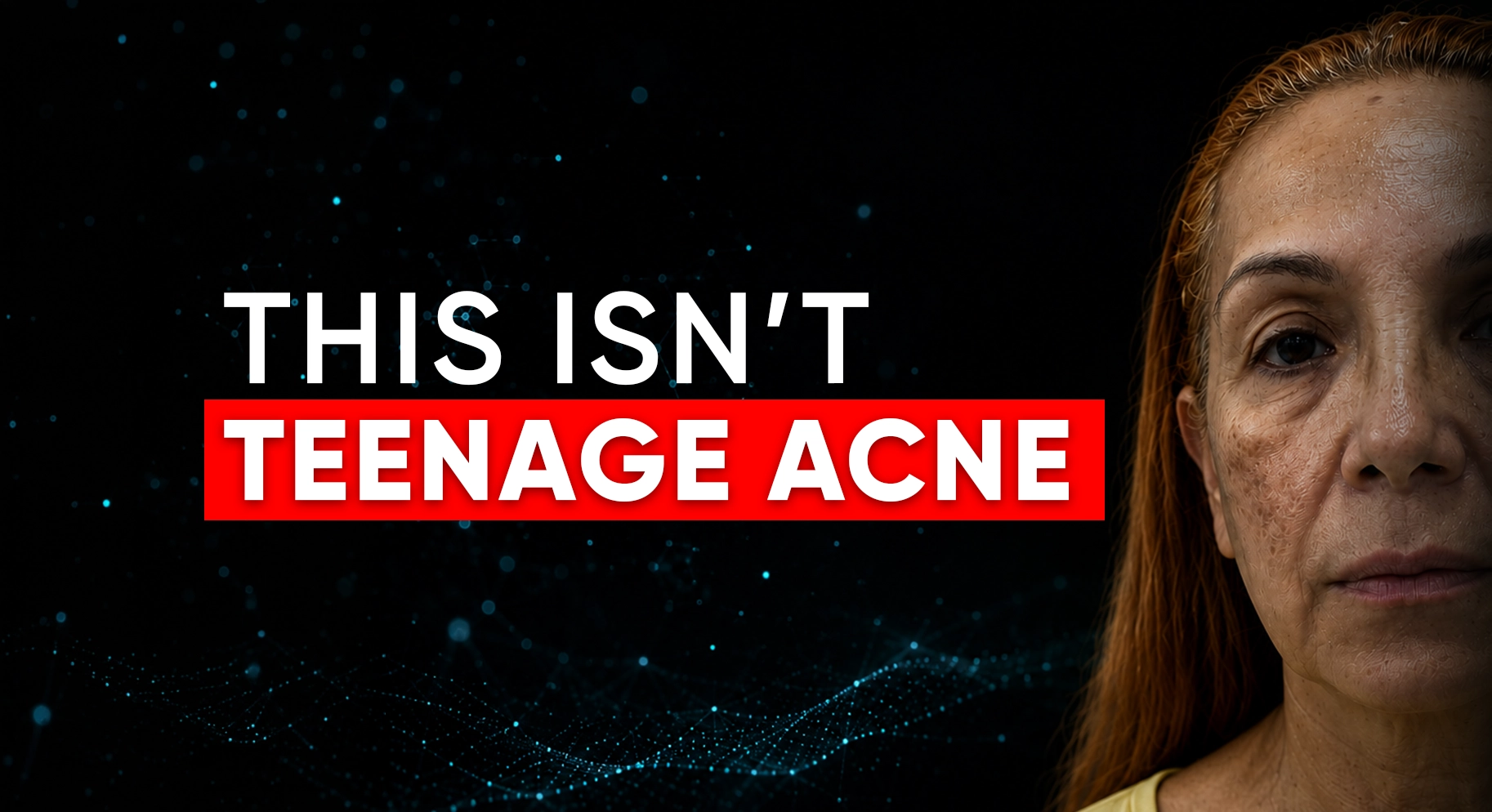 Perfect-B-Blog-Acne After 40-portrait