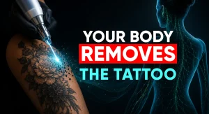 Perfect-B-Blog-How-Does-Laser-Tattoo-Removal-Work-portrait