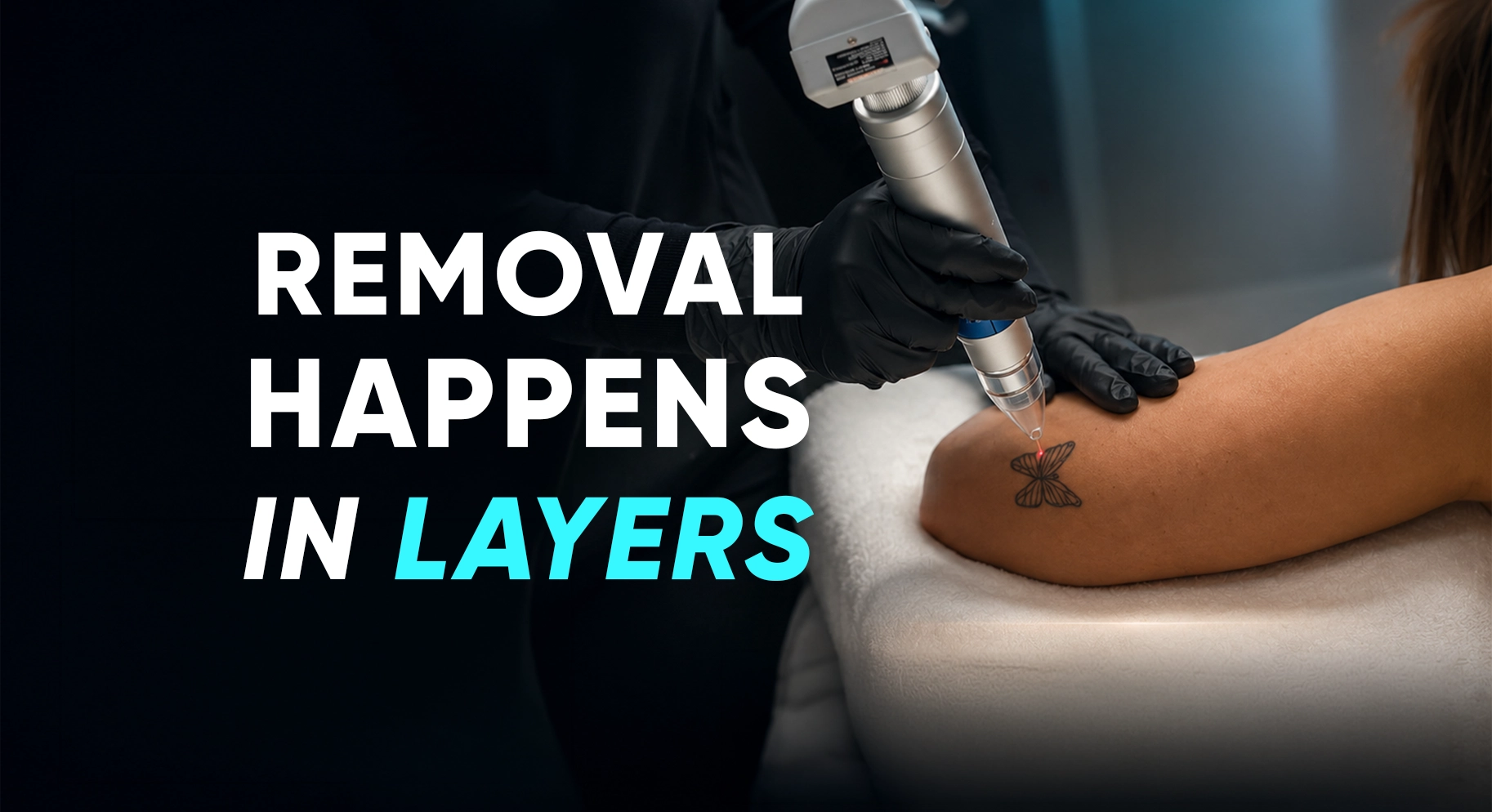 Perfect-B-Blog-How Many Sessions Does Tattoo Removal Take-portrait