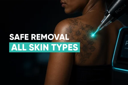 Perfect-B-Blog-Laser-Tattoo-Removal-on-Dark-Skin-in-Miami-portrait