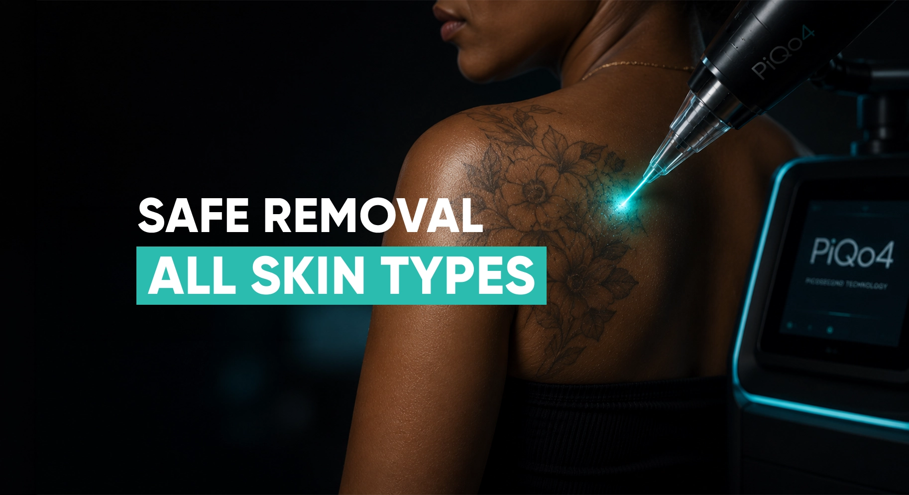 Perfect-B-Blog-Laser-Tattoo-Removal-on-Dark-Skin-in-Miami-portrait