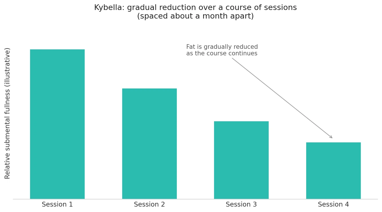 Perfect B - Blog - Kybella Double Chin - chart showing sessions spaced about a month apart over a treatment course